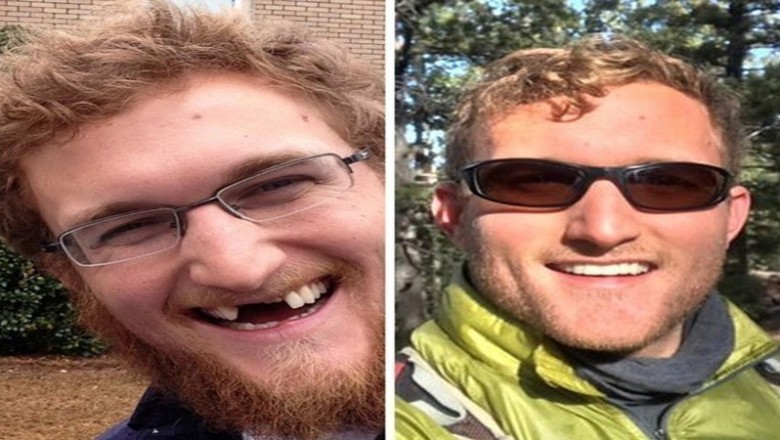 20 osób, które podjęły walkę o nowy wizerunek. Ich metamorfozy inspirują