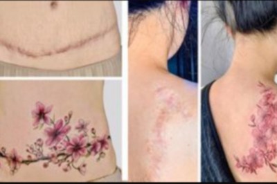 Pokrywa blizny klientów pięknymi tatuażami i  pomaga ludziom odzyskać pewność siebie