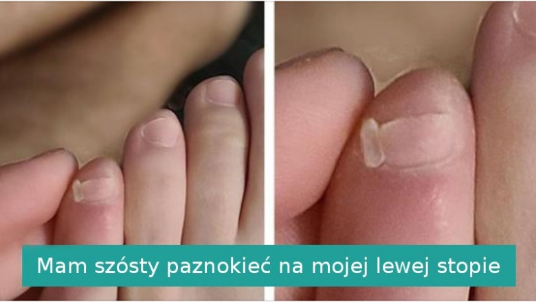 15 szczęściarzy który otrzymali coś więcej od matki natury