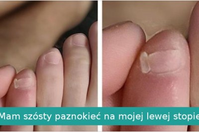 15 szczęściarzy który otrzymali coś więcej od matki natury 