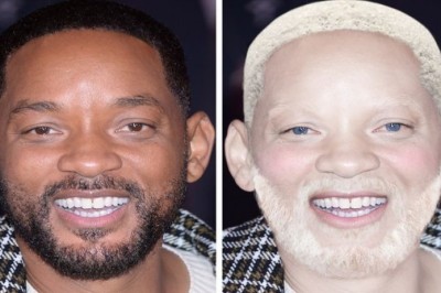 Oto jak wyglądałoby 15 gwiazd, gdyby były albinosami. Czy nadal są piękni 