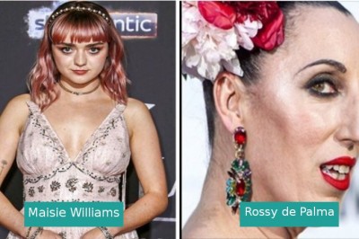 Te gwiazdy nie przejmują się standardami piękna narzucanymi przez społeczeństwo