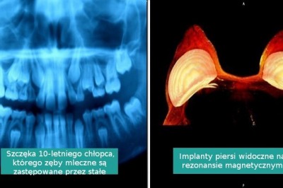 15 niezwykłych zdjęć wnętrza ludzkiego ciała, których nie widzimy na co dzień
