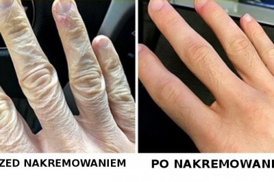 20 zdjęć przed i po, pokazujących, że czas i włożony wysiłek potrafią zdziałać cuda