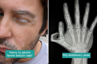 17 osób i zwierząt o niecodziennych cechach wyglądu