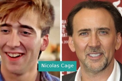 14 gwiazd, które dopiero z dojściem do sławy zyskały swój olśniewający uśmiech