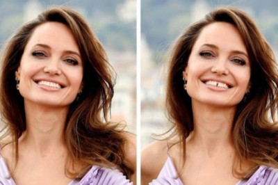 15 zdjęć pokazujących jak nie idealne zęby potrafią zmienić twoją twarz