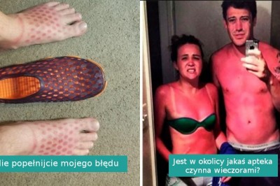 15 osób, które już nigdy nie zapomną o nałożeniu kremu przeciwsłonecznego