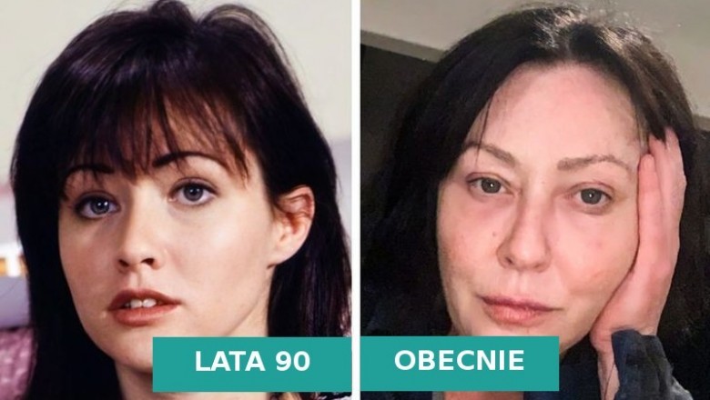 Zobacz jak wygląda dziś 12 popularnych gwiazd które w latach 90 były na szczycie