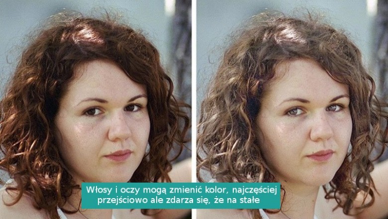 8 zmian zachodzących w ciele kobiety po urodzeniu dziecka. Niektóre negatywne