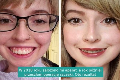 18 osób, których uśmiech opłacony został bardzo dużym wysiłkiem i wyrzeczeniami
