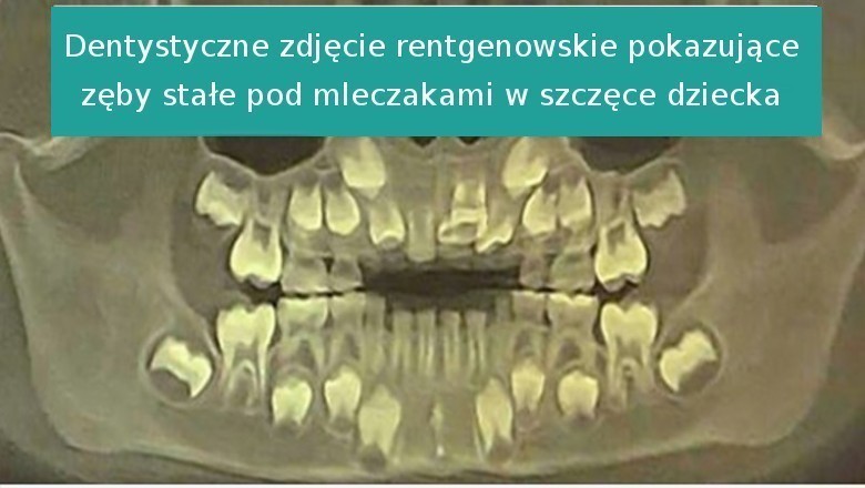 14 zdjęć rentgenowskich odkrywających niewidzialną stronę naszego świata