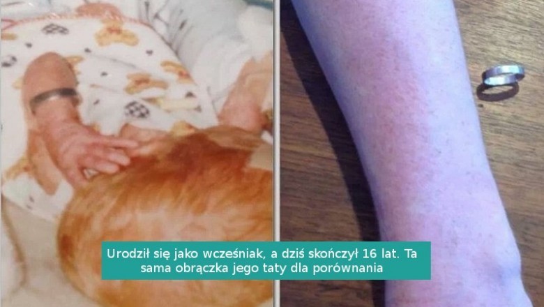 17 zdjęć pokazujących nieubłagany upływ czasu i jego wpływ na nasze życie