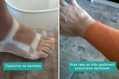 17 osób, które niechcący przesadziły ze swoją opalenizną