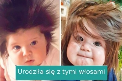 18 osób, które otrzymały niezwykłe i zaskakujące dary od natury