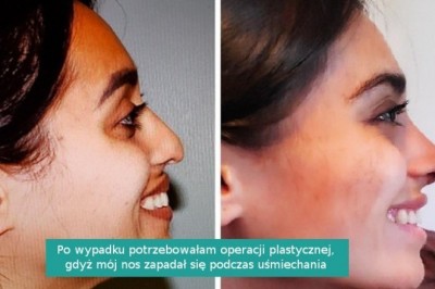 14 osób, które włożyły sporo wysiłku, żeby zmienić się nie do poznania