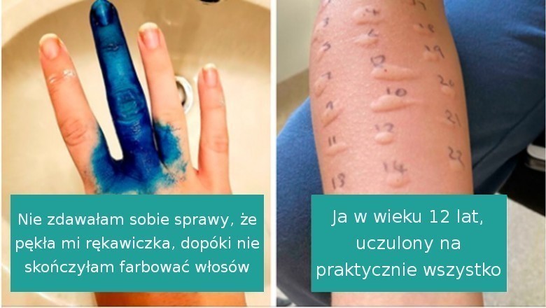 18 osób, które prawdopodobnie przeżyły gorszy dzień od ciebie. Tak wygląda pech