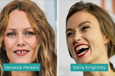 16 gwiazd, które zaakceptowały swój idealnie niedoskonały uśmiech