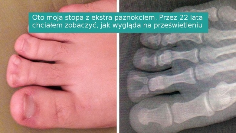 16 osób, które napotkały na swojej drodze coś unikalnego