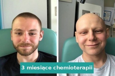 14 fotografii „przed i po”, które sprawią, że ze zdumienia przetrzesz oczy