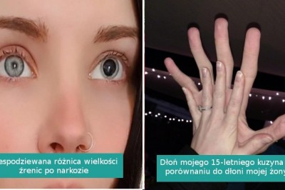 13 nieoczekiwanych fotografii pokazujących, jak zaskakujące bywa nasze ciało