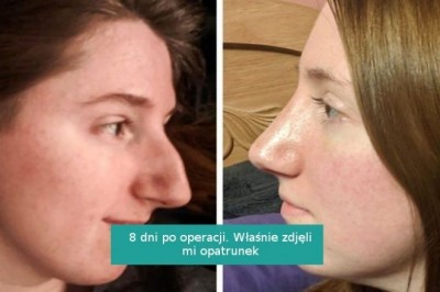 Fotografie przed i po, pokazujące, że mała zmiana potrafi zrobić ogromną różnicę