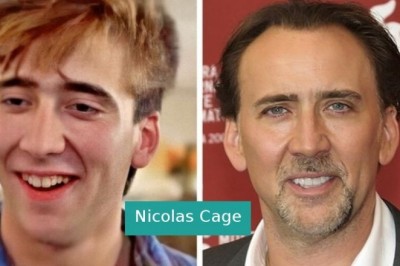 14 gwiazd, które dopiero po dojściu do sławy zyskały swój olśniewający uśmiech