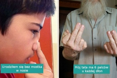 Cechy genetyczne tych osób należą do naprawdę wyjątkowych i rzadkich