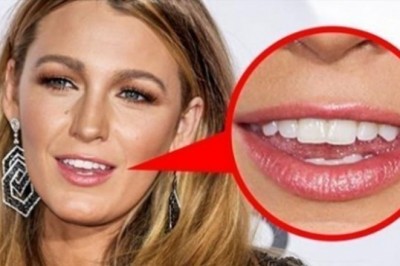 Celebryci mają swoje sposoby, aby dobrze wyjść na zdjęciach. To niektóre z nich