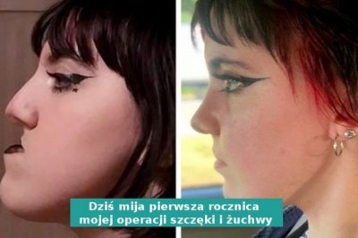 16 osób, które zdecydowały się na operację plastyczną i trafiły w dziesiątkę