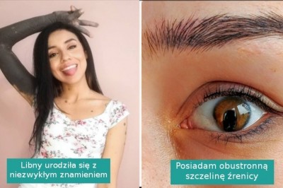 15 fotografii pokazujących, że piękno wcale nie wymaga perfekcji ani ideału